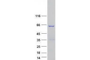 Western Blotting (WB) image for tRNA Splicing Endonuclease 54 (TSEN54) protein (Myc-DYKDDDDK Tag) (ABIN2734441)