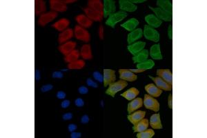 ABIN7096825 and ABIN7100891 staining Hela cells(45 min of heat-shock treatment) by IF/ICC. (CRISP1 抗体)