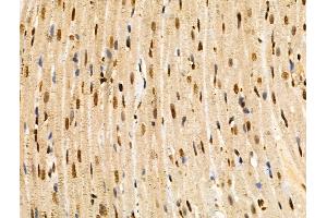 ABIN6258822 and ABIN6274418 at 1/100 staining Rat heart tissue by IHC-P. (MAP4K3 抗体  (N-Term))