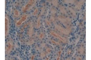 Detection of Ang1-7 in Rat Kidney Tissue using Polyclonal Antibody to Angiotensin 1-7 (Ang1-7) (Angiotensin 1-7 抗体)