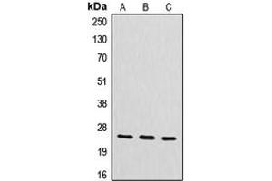 Western blot analysis of CYB561D2 expression in HeLa (A), mouse liver (B), rat kidney (C) whole cell lysates. (CYB561D2 抗体  (Center))