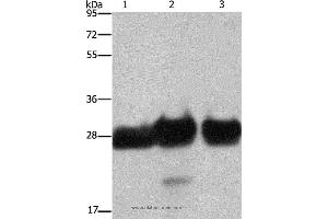 Western blot analysis of Human adrenal pheochromocytoma, fetal muscle and skeletal muscle tissue, using FHL1 Polyclonal Antibody at dilution of 1:500