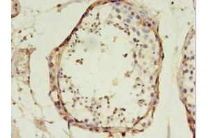 Immunohistochemistry of paraffin-embedded human testis tissue using ABIN7172467 at dilution of 1:100 (TFAM 抗体  (AA 43-246))