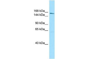 WB Suggested Anti-AQR Antibody Titration: 1. (AQR 抗体  (C-Term))