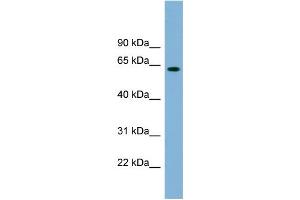 WB Suggested Anti-SLFN12 Antibody Titration: 0. (SLFN12 抗体  (Middle Region))