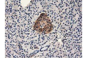Immunohistochemical staining of paraffin-embedded Human pancreas tissue using anti-MICAL1 mouse monoclonal antibody.