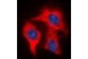 Immunofluorescent analysis of FAP alpha staining in HeLa cells. (FAP 抗体)