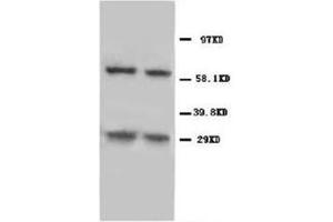 Western blot analysis of rat thymus tissue lysis using NIP3 antibody (BNIP3 抗体  (C-Term))