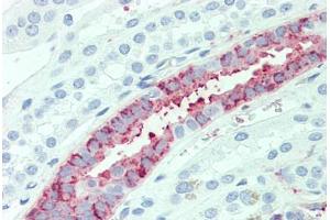 Immunohistochemistry (IHC) image for anti-Solute Carrier Family 4, Anion Exchanger, Member 2 (erythrocyte Membrane Protein Band 3-Like 1) (SLC4A2) (N-Term) antibody (ABIN1049340)