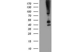 Western Blotting (WB) image for anti-serpin Peptidase Inhibitor, Clade B (Ovalbumin), Member 13 (SERPINB13) antibody (ABIN1500878) (SERPINB13 抗体)
