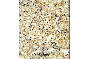 Immunohistochemistry (Paraffin-embedded Sections) (IHC (p)) image for anti-CD40 Ligand (CD40LG) (AA 181-207), (C-Term) antibody (ABIN652211)