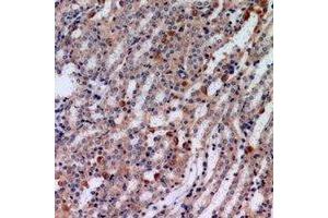 Immunohistochemical analysis of Tensin 3 staining in human kindey formalin fixed paraffin embedded tissue section. (TNS3 抗体)