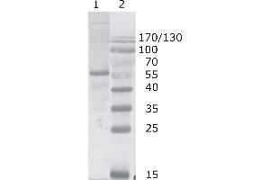Western Blot testing of HIV-1 p24 antibody, clone N29. (HIV-1 p24 抗体  (N-Term))
