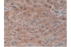 IHC-P analysis of Human Liver Tissue, with DAB staining. (HPR 抗体  (AA 70-332))