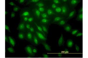 Immunofluorescence of monoclonal antibody to STK4 on HeLa cell. (STK4 抗体  (AA 391-485))