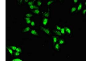 Immunofluorescent analysis of Hela cells using ABIN7155835 at dilution of 1:100 and Alexa Fluor 488-congugated AffiniPure Goat Anti-Rabbit IgG(H+L) (OTX1 抗体  (AA 29-244))