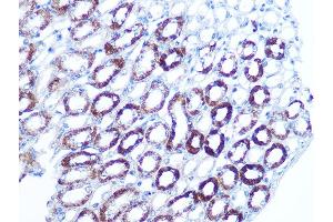 Immunohistochemistry of paraffin-embedded mouse kidney using B Rabbit mAb (ABIN7265850) at dilution of 1:100 (40x lens). (BAG3 抗体)