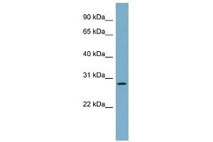 DNAJB9 antibody used at 1 ug/ml to detect target protein. (DNAJB9 抗体)