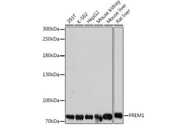 FREM1 抗体
