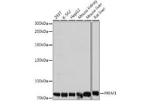 Western blot analysis of extracts of various cell lines using FREM1 Polyclonal Antibody at dilution of 1:1000. (FREM1 抗体)