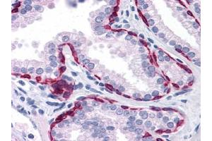 Immunohistochemistry (IHC) image for anti-Keratin 81 (KRT81) (AA 1-203) antibody (ABIN614629) (KRT81 抗体  (AA 1-203))