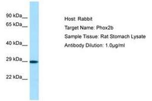 Image no. 1 for anti-Paired-Like Homeobox 2b (PHOX2B) (N-Term) antibody (ABIN6749847) (PHOX2B 抗体  (N-Term))