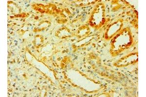 Immunohistochemistry of paraffin-embedded human kidney tissue using ABIN7149303 at dilution of 1:100 (CISH 抗体  (AA 1-257))