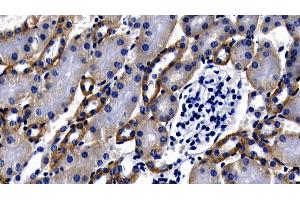 Detection of MyD88 in Mouse Kidney Tissue using Polyclonal Antibody to Myeloid Differentiation Factor 88 (MyD88) (MYD88 抗体  (AA 1-296))