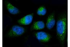IF analysis of Fibulin 1/FBLN1 using anti-Fibulin 1/FBLN1 antibody (ABIN7601231).