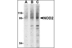 Western blot analysis of NOD2 in Jurkat cell lysate with this product at (A) 1, (B) 2 and (C) 4 μg/ml. (NOD2 抗体  (N-Term))