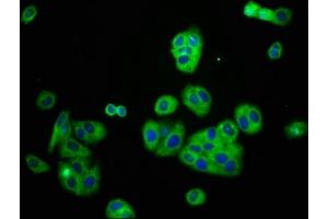 Immunofluorescence (IF) image for anti-Potassium Inwardly-Rectifying Channel, Subfamily J, Member 8 (KCNJ8) (AA 299-424) antibody (ABIN7145029)