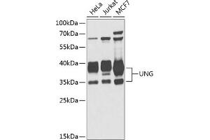 Western blot analysis of extracts of various cell lines, using UNG antibody (ABIN6133476, ABIN6149934, ABIN6149936 and ABIN6216305) at 1:1000 dilution. (UNG 抗体  (AA 1-313))