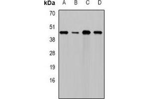 Western blot analysis of DAP expression in HepG2 (A), Hela (B), NIH3T3 (C), rat testis (D) whole cell lysates. (DAP 抗体)