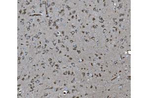 IHC analysis of INPPL1 using anti-INPPL1 antibody (ABIN7599785).
