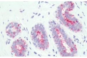 Immunohistochemistry (IHC) image for anti-Prostaglandin E Receptor 3 (Subtype EP3) (PTGER3) (Cytoplasmic Domain) antibody (ABIN1049256)