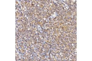 Immunohistochemistry of paraffin-embedded human tonsil using NF Rabbit pAb (ABIN3017384, ABIN3017385, ABIN3017386 and ABIN6220063) at dilution of 1:100 (40x lens). (NFAT1 抗体)