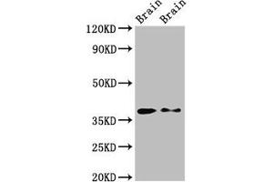 Western Blot Positive WB detected in: Rat brain tissue, Mouse brain tissue All lanes: PEX10 antibody at 2. (PEX1 抗体  (AA 63-157))