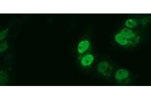 Anti-ARNTL mouse monoclonal antibody (ABIN2452787) immunofluorescent staining of COS7 cells transiently transfected by pCMV6-ENTRY ARNTL (RC207870). (ARNTL 抗体)