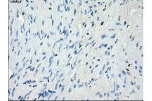 Immunohistochemical staining of paraffin-embedded Ovary tissue using anti-PRKAR1Amouse monoclonal antibody. (PRKAR1A 抗体)