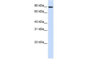 DLG3 antibody used at 1 ug/ml to detect target protein. (DLG3 抗体)