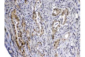 IHC analysis of MED4 using anti-MED4 antibody . (MED4 抗体  (AA 27-140))