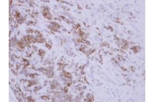 IHC-P Image Immunohistochemical analysis of paraffin-embedded BT483 xenograft, using TID1, antibody at 1:250 dilution. (DNAJA3 抗体  (Center))