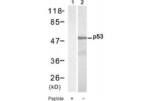 Image no. 1 for anti-Tumor Protein P53 (TP53) (Ser9) antibody (ABIN319301) (p53 抗体  (Ser9))