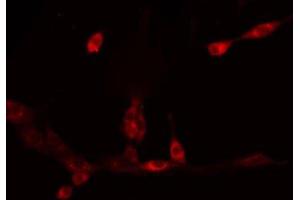 Immunofluorescence (fixed cells) (IF/ICC) image for anti-Cytochrome P450, Family 11, Subfamily A, Polypeptide 1 (CYP11A1) (C-Term) antibody (ABIN6258048)