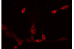 ABIN6275761 staining HeLa by IF/ICC. (CYP11A1 抗体  (C-Term))