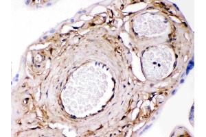 Galectin 1 was detected in paraffin-embedded sections of human placenta tissues using rabbit anti- Galectin 1 Antigen Affinity purified polyclonal antibody (Catalog # ) at 1 µg/mL. (LGALS1/Galectin 1 抗体  (AA 2-135))