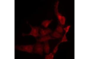 ABIN6275140 staining LOVO by IF/ICC. (GABRg1 抗体  (N-Term))