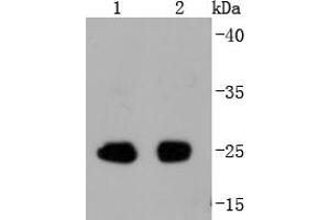 Lane 1: Mouse spleen, Lane 2: Rat spleen cell lysate probed with eIF4E(S209) (2B1) Monoclonal Antibody  at 1:1000 overnight at 4˚C. (EIF4E 抗体  (pSer209))
