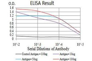 Black line: Control Antigen (100 ng),Purple line: Antigen (10 ng), Blue line: Antigen (50 ng), Red line:Antigen (100 ng) (GFPT1 抗体  (AA 536-681))