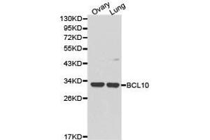 Western Blotting (WB) image for anti-B-Cell CLL/lymphoma 10 (BCL10) antibody (ABIN1871246) (BCL10 抗体)